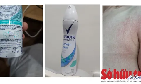 Sản phẩm Rexona Shower Clean bị khách hàng tố phải nhập viện sau khi sử dụng?
