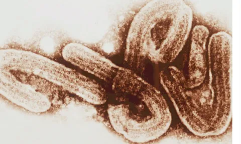 Cảnh báo đợt bùng phát virus Marburg, tỷ lệ tử vong lên tới 88%