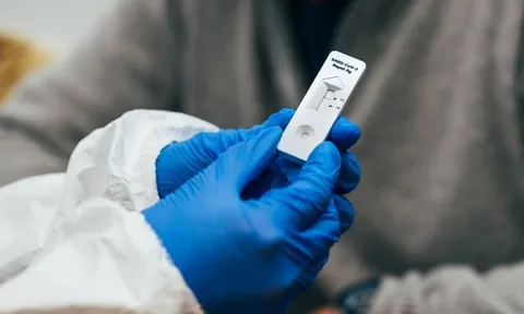 Vạch kit test Covid-19 lúc mờ lúc đậm có ý nghĩa gì?