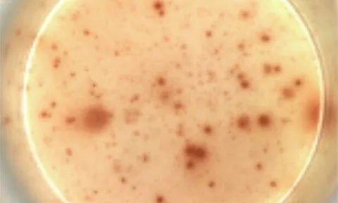 Đột phá: Một mũi "vắc-xin" có thể trị dứt HIV/AIDS