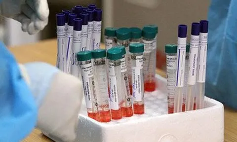 Sáng 6/2, Việt Nam không có ca mắc mới COVID-19