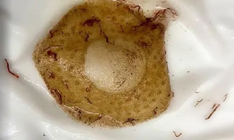 Đường nước sinh hoạt KĐT Pháp Vân - Tứ Hiệp đầy giun sán: Các bên liên quan nói gì?