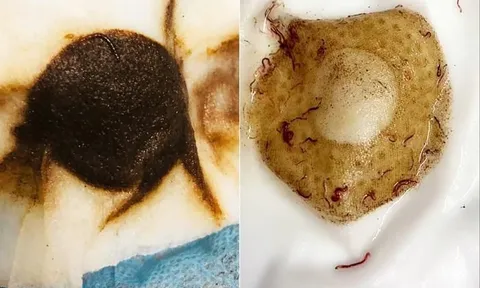 Vụ giun sán xuất hiện trong nước sinh hoạt tại khu đô thị Pháp Vân - Tứ Hiệp: Chờ kết quả mẫu nước để xác định nguyên nhân