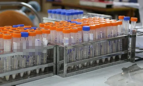 Loạn giá xét nghiệm Covid-19: Bộ Y tế nói gì?