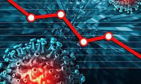 Kinh tế Việt Nam bị tác động bởi nền kinh tế toàn cầu hậu Covid-19