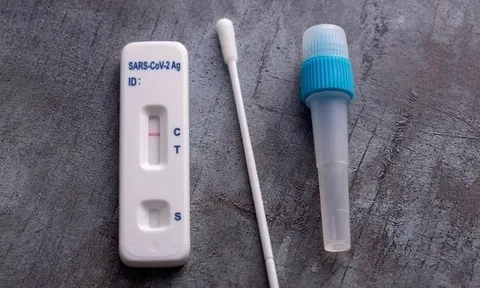 Công nhận kết quả tự test nhanh tại nhà của F0