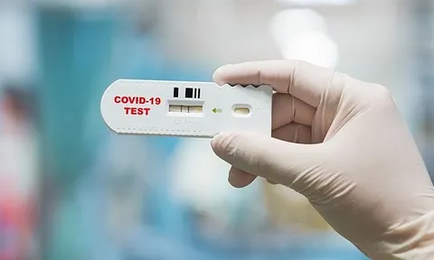 Bác sĩ Trương Hữu Khanh: Test nhanh Covid-19 thế nào để hiệu quả, ít tốn kém?