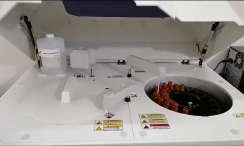 Tiếp tục thanh toán dịch vụ kỹ thuật trên máy mượn, đặt của nhà thầu trúng thầu vật tư, hóa chất