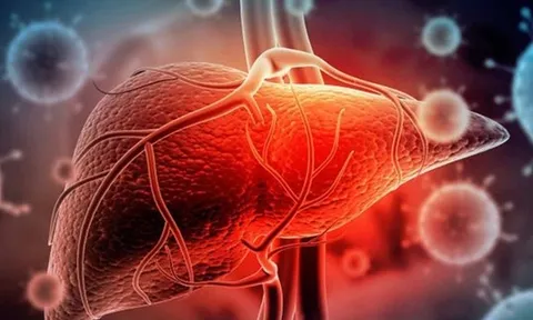 Dịch viêm gan bí ẩn lan ra ít nhất 23 quốc gia