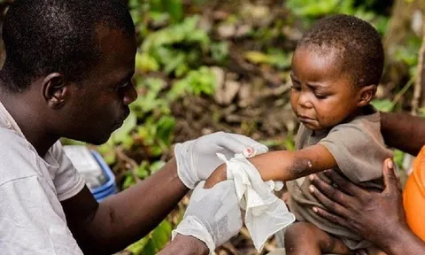 Mức độ nguy hiểm của bệnh đậu mùa khỉ khiến WHO họp khẩn