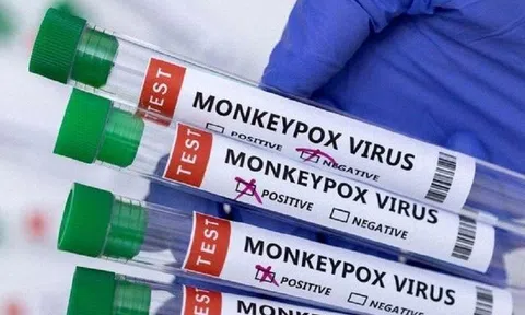 Virus đậu mùa khỉ đang tiến hóa "thần tốc" nhanh gấp 12 lần