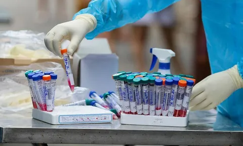 TP HCM có ca bệnh đậu mùa khỉ đầu tiên