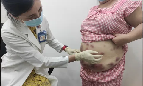 Thẩm mỹ viện ở TPHCM tiêm hủy mỡ làm nát bụng người phụ nữ rồi... biến mất